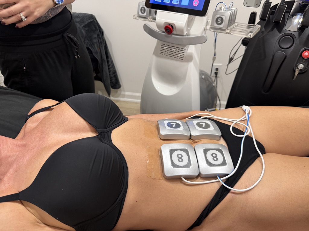 Body sculpting belly treatment in progress at 11 North Aesthetics