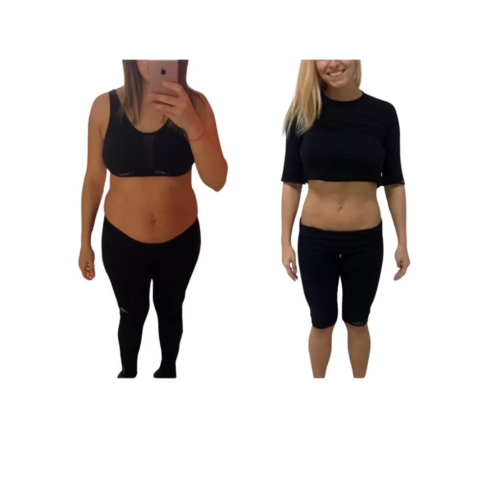 Before and after photo of a client's belly after Body Sculpting treatment